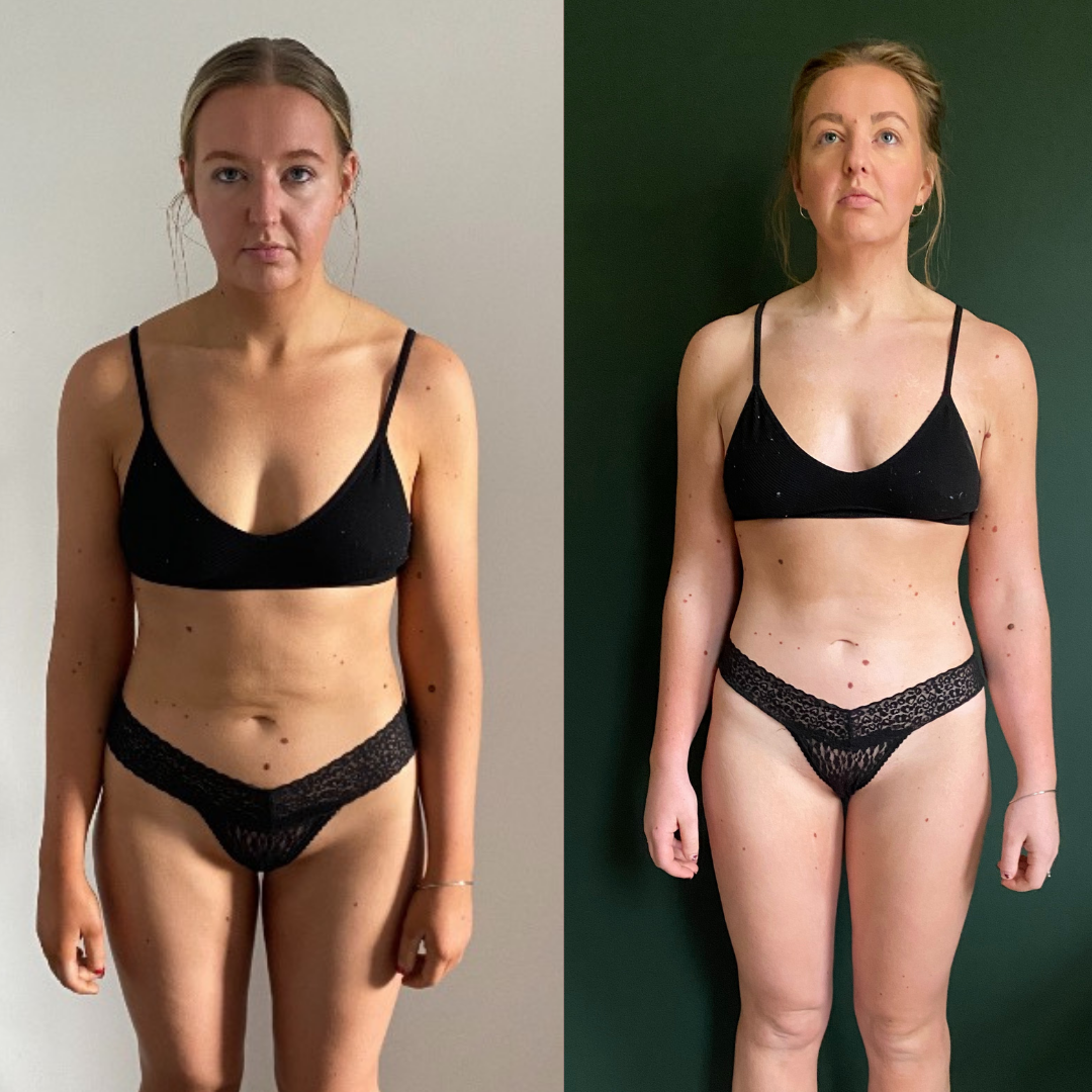 Real client transformation 4, shown before and after
