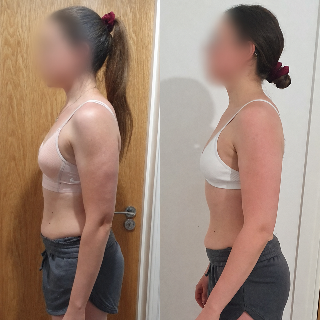 Real client transformation 5, shown before and after