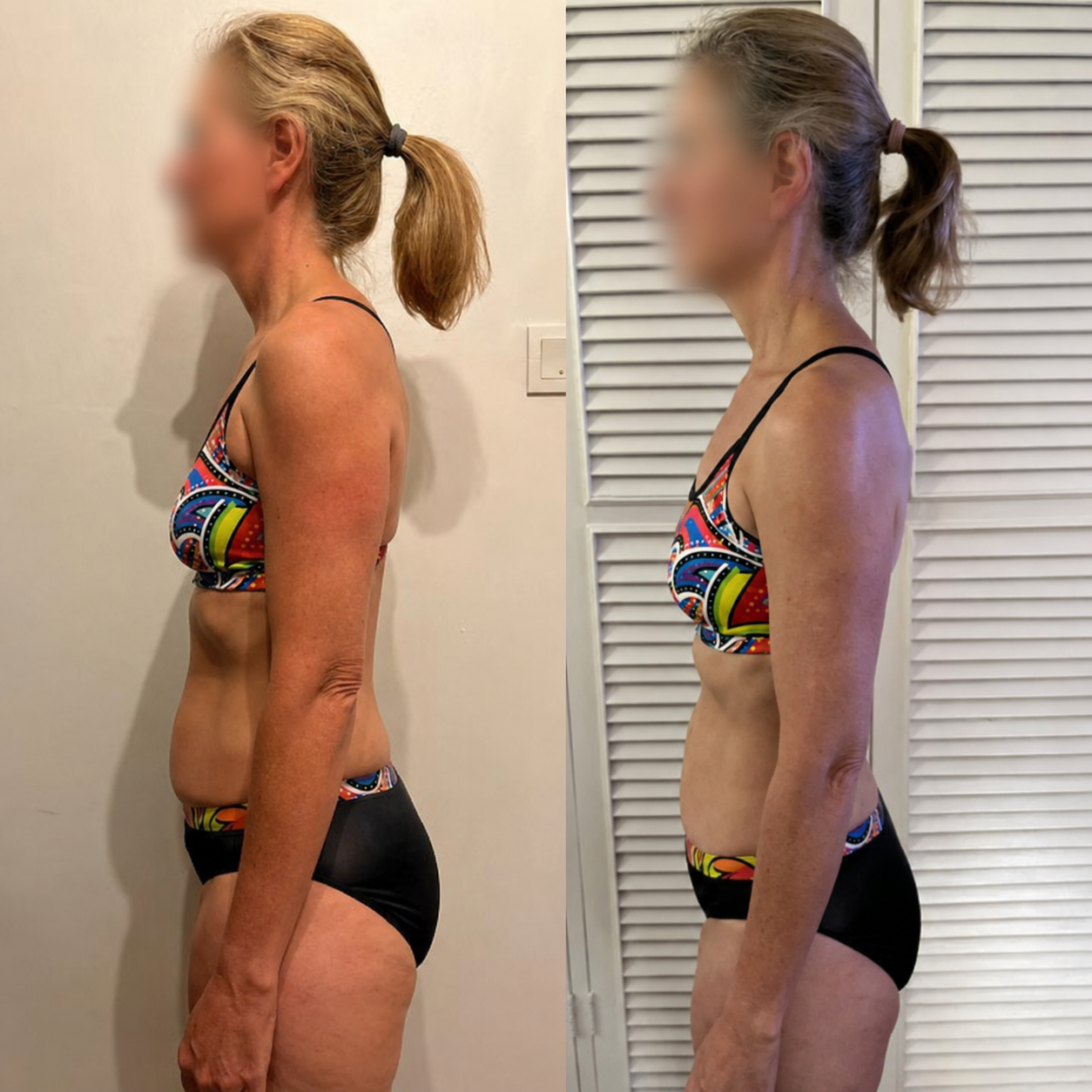 Real client transformation 6, shown before and after